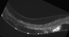 C02C6.1a_BC13292_GFP_a-3_1.jpg